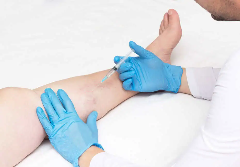 Spider Vein Treatment by Advanced Medical Spas in Duluth, GA